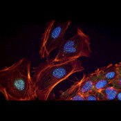 10D9G11_media-01.jpg IF of P19 mouse cells labeled with DSHB antibody 10D9G11 against Germ Cell Nuclear Antigen 1 (green).
